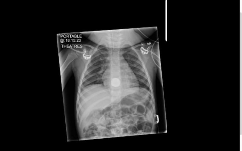 Other image for Tot is lucky to be alive